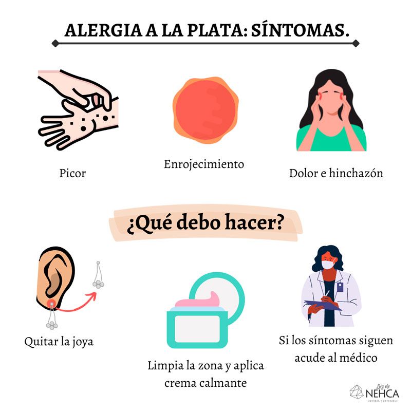 Alergia a la plata: síntomas